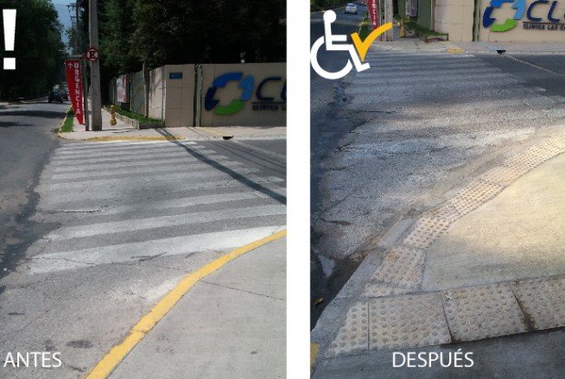 Antes y después rebaje clinica las condes_antes y después